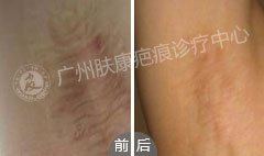 ���ݷ���Ƥ����ҽԺ