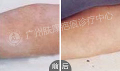 ���ݷ���Ƥ����ҽԺ