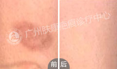 ���ݷ���Ƥ����ҽԺ