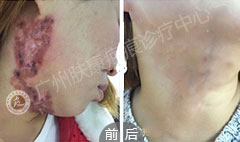 广州肤康皮肤病医院