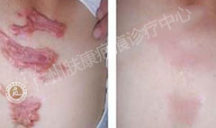 ���ݷ���Ƥ����ҽԺ