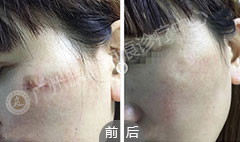 ���ݷ���Ƥ����ҽԺ