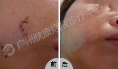 ���ݷ���Ƥ����ҽԺ