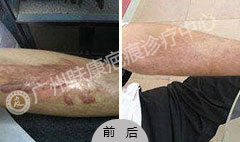 ���ݷ���Ƥ����ҽԺ