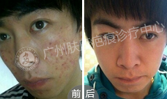 ���ݷ���Ƥ����ҽԺ