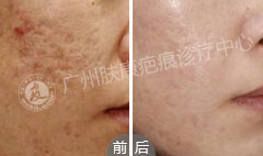 ���ݷ���Ƥ����ҽԺ