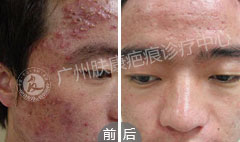 ���ݷ���Ƥ����ҽԺ