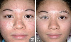 广州肤康皮肤病医院