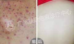 ���ݷ���Ƥ����ҽԺ