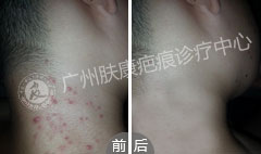 ���ݷ���Ƥ����ҽԺ