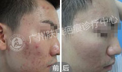 ���ݷ���Ƥ����ҽԺ