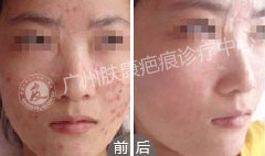 广州肤康皮肤病医院