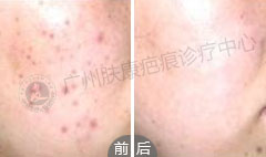 ���ݷ���Ƥ����ҽԺ