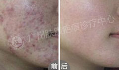 ���ݷ���Ƥ����ҽԺ