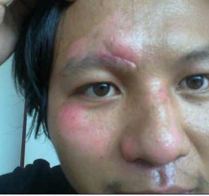 ���ݷ���Ƥ����ҽԺ