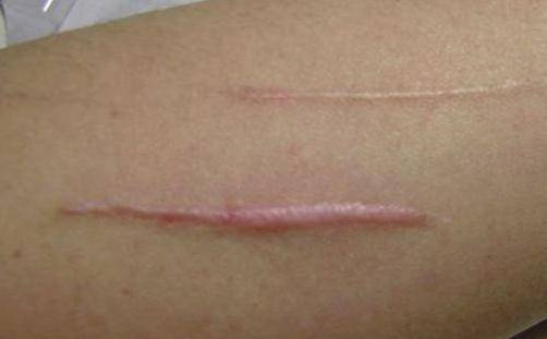 ���ݷ���Ƥ����ҽԺ