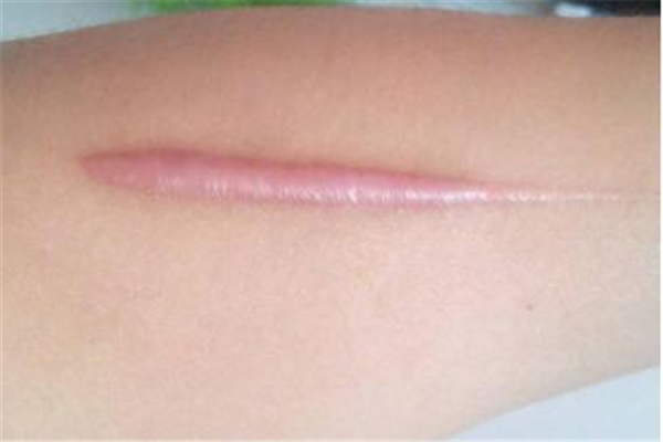 广州肤康皮肤病医院