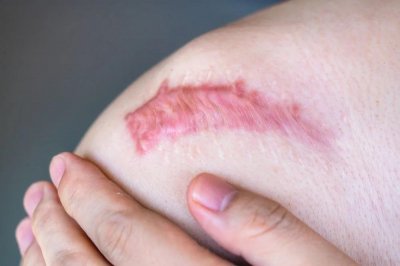 ���ݷ���Ƥ����ҽԺ